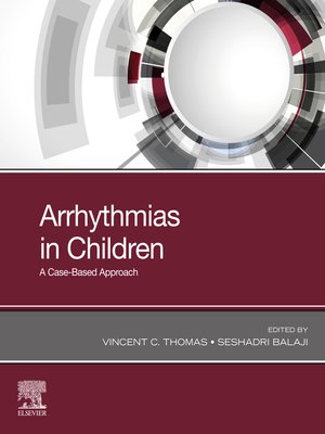 cover image of Arrhythmias in Children